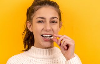 invisible braces